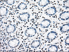 Immunohistochemical staining of paraffin-embedded Human colon tissue within the normal limits using anti-CNDP1 mouse monoclonal antibody