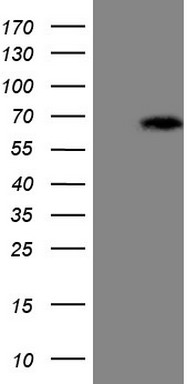 HEK293T cells were transfected with the pCMV6-ENTRY control (Left lane) or pCMV6-ENTRY ASB2 (Right lane) cDNA for 48 hrs and lysed. Equivalent amounts of cell lysates (5 ug per lane) were separated by SDS-PAGE and immunoblotted with anti-ASB2 (1:500).