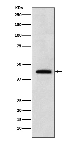 Western blot analysis of Renalase expression in 293T cell lysate.