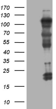 HEK293T cells were transfected with the pCMV6-ENTRY control (Left lane) or pCMV6-ENTRY UHRF2 (Right lane) cDNA for 48 hrs and lysed