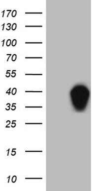 HEK293T cells were transfected with the pCMV6-ENTRY control (Left lane) or pCMV6-ENTRY SSU72 (Right lane) cDNA for 48 hrs and lysed. Equivalent amounts of cell lysates (5 ug per lane) were separated by SDS-PAGE and immunoblotted with anti-SSU72 (1:2000).