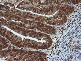 m06298 anti mapk4 mouse monoclonal antibody clone id oti2d7 ihc testing 5