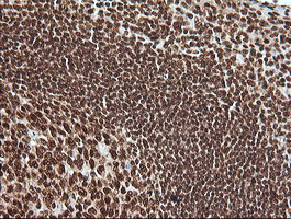 m06298 anti mapk4 mouse monoclonal antibody clone id oti2d7 ihc testing 6