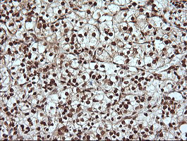m06298 anti mapk4 mouse monoclonal antibody clone id oti2d7 ihc testing 8