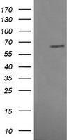 HEK293T cells were transfected with the pCMV6-ENTRY control (Left lane) or pCMV6-ENTRY MAPK4 (Right lane) cDNA for 48 hrs and lysed