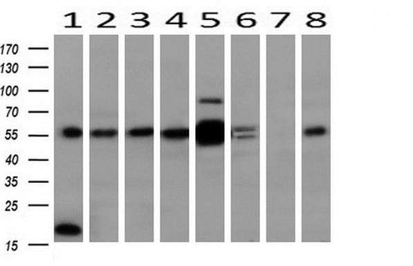 Western blot analysis of extracts (10ug) from 8 Human tissue by using anti-MAPK4 monoclonal antibody at 1:200 (1: Testis; 2: Uterus; 3: Breast; 4: Brain; 5: Liver; 6: Ovary; 7: Thyroid gland; 8: Colon)