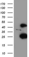 HEK293T cells were transfected with the pCMV6-ENTRY control (Left lane) or pCMV6-ENTRY CENPH (Right lane) cDNA for 48 hrs and lysed