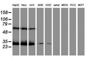 Western blot analysis of extracts (35ug) from 9 different cell lines by using anti-CENPH monoclonal antibody (HepG2: human; HeLa: human; SVT2: mouse; A549: human; COS7: monkey; Jurkat: human; MDCK: canine; PC12: rat; MCF7: human)