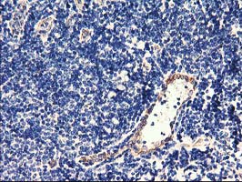 Immunohistochemical staining of paraffin-embedded Human tonsil within the normal limits using anti-CENPH mouse monoclonal antibody