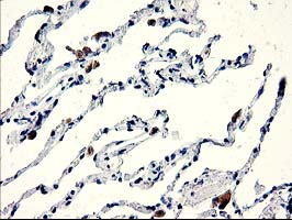 m06302 anti cenph mouse monoclonal antibody clone id oti2g4 ihc testing 4