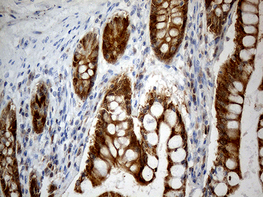 m06312 anti chchd10 mouse monoclonal antibody clone id oti3b8 ihc testing 5