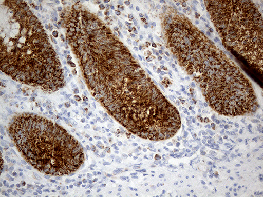 m06312 anti chchd10 mouse monoclonal antibody clone id oti3b8 ihc testing 6