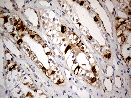 m06312 anti chchd10 mouse monoclonal antibody clone id oti3b8 ihc testing 7
