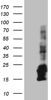 HEK293T cells were transfected with the pCMV6-ENTRY control (Left lane) or pCMV6-ENTRY CHCHD10 (Right lane) cDNA for 48 hrs and lysed