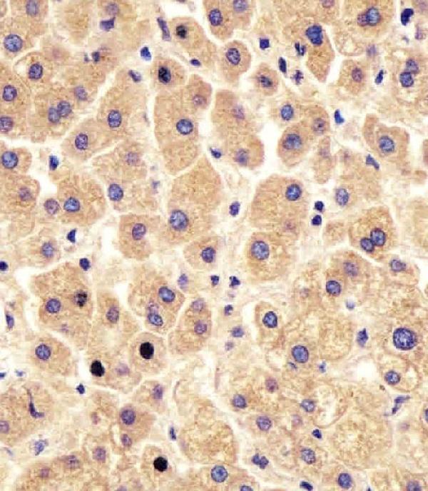 m06317 anti pygl antibody c term ihc p testing 2
