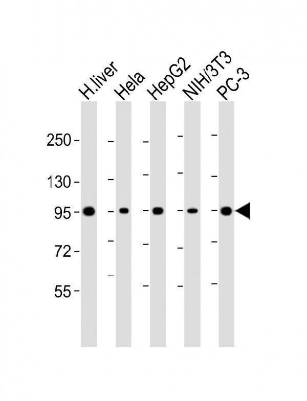 m06317 anti pygl antibody c term wb testing 1