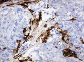 m06329 1 anti thymidine phosphorylase tymp mouse monoclonal antibody clone id oti7a6 ihc testing 10