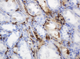 m06329 1 anti thymidine phosphorylase tymp mouse monoclonal antibody clone id oti7a6 ihc testing 11