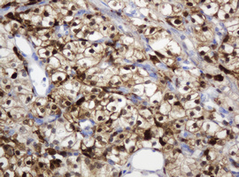m06329 1 anti thymidine phosphorylase tymp mouse monoclonal antibody clone id oti7a6 ihc testing 12