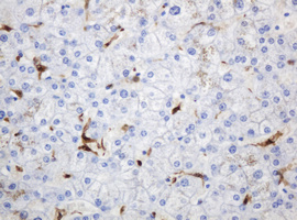 m06329 1 anti thymidine phosphorylase tymp mouse monoclonal antibody clone id oti7a6 ihc testing 13