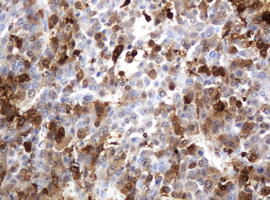 m06329 1 anti thymidine phosphorylase tymp mouse monoclonal antibody clone id oti7a6 ihc testing 14