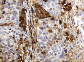 m06329 1 anti thymidine phosphorylase tymp mouse monoclonal antibody clone id oti7a6 ihc testing 3