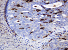 m06329 1 anti thymidine phosphorylase tymp mouse monoclonal antibody clone id oti7a6 ihc testing 4