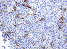 m06329 1 anti thymidine phosphorylase tymp mouse monoclonal antibody clone id oti7a6 ihc testing 5