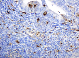 m06329 1 anti thymidine phosphorylase tymp mouse monoclonal antibody clone id oti7a6 ihc testing 6