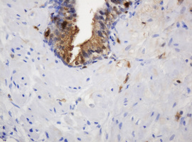 m06329 1 anti thymidine phosphorylase tymp mouse monoclonal antibody clone id oti7a6 ihc testing 7