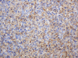 m06329 1 anti thymidine phosphorylase tymp mouse monoclonal antibody clone id oti7a6 ihc testing 8