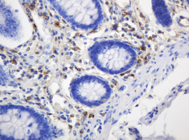m06329 1 anti thymidine phosphorylase tymp mouse monoclonal antibody clone id oti7a6 ihc testing 9