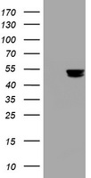 m06329 1 anti thymidine phosphorylase tymp mouse monoclonal antibody clone id oti7a6 wb testing 1