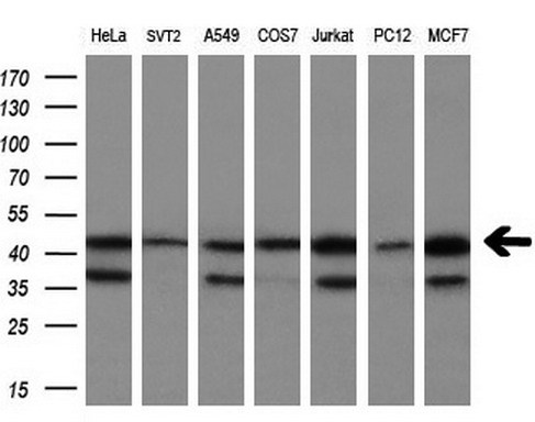 m06331 1 anti cndp2 mouse monoclonal antibody clone id oti6d3 wb testing 2