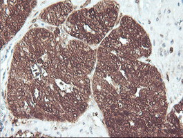 m06331 anti cndp2 mouse monoclonal antibody clone id oti8a2 ihc testing 2
