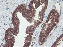 m06331 anti cndp2 mouse monoclonal antibody clone id oti8a2 ihc testing 4