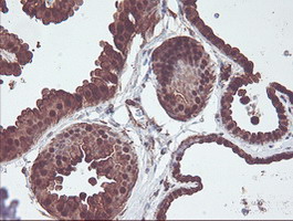 m06331 anti cndp2 mouse monoclonal antibody clone id oti8a2 ihc testing 5