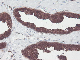 m06331 anti cndp2 mouse monoclonal antibody clone id oti8a2 ihc testing 6
