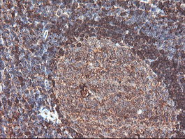 m06331 anti cndp2 mouse monoclonal antibody clone id oti8a2 ihc testing 7