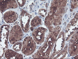m06331 anti cndp2 mouse monoclonal antibody clone id oti8a2 ihc testing 8