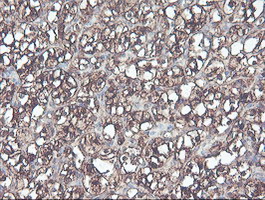 m06331 anti cndp2 mouse monoclonal antibody clone id oti8a2 ihc testing 9