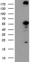 m06331 anti cndp2 mouse monoclonal antibody clone id oti8a2 wb testing 1