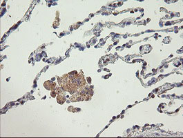 m06334 anti agtpbp1 mouse monoclonal antibody clone id oti9a3 ihc testing 5