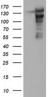 HEK293T cells were transfected with the pCMV6-ENTRY control (Left lane) or pCMV6-ENTRY AGTPBP1 (Right lane) cDNA for 48 hrs and lysed