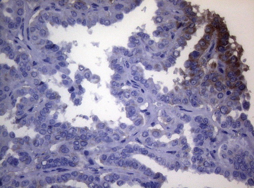 m06345 anti opa3 mouse monoclonal antibody clone id oti3g4 ihc testing 2
