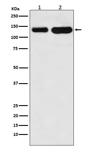 Western blot analysis of K Cadherin expression in (1) Jurkat cell lysate; (2) Mouse heart lysate