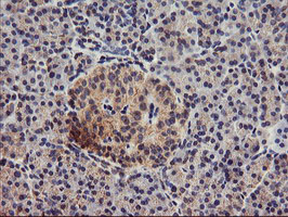 m06354 1 anti dgka mouse monoclonal antibody clone id oti4a11 ihc testing 2