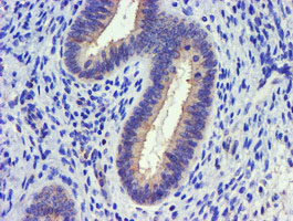 m06354 1 anti dgka mouse monoclonal antibody clone id oti4a11 ihc testing 3