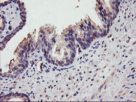 m06354 1 anti dgka mouse monoclonal antibody clone id oti4a11 ihc testing 4