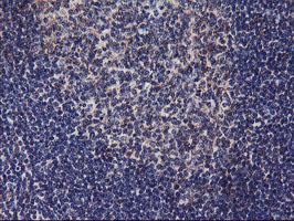 m06354 1 anti dgka mouse monoclonal antibody clone id oti4a11 ihc testing 5